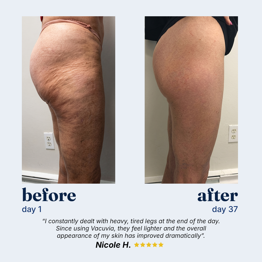 Cotitoc® Firmer, More Toned Skin