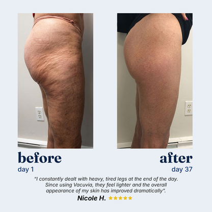 Cotitoc® Firmer, More Toned Skin