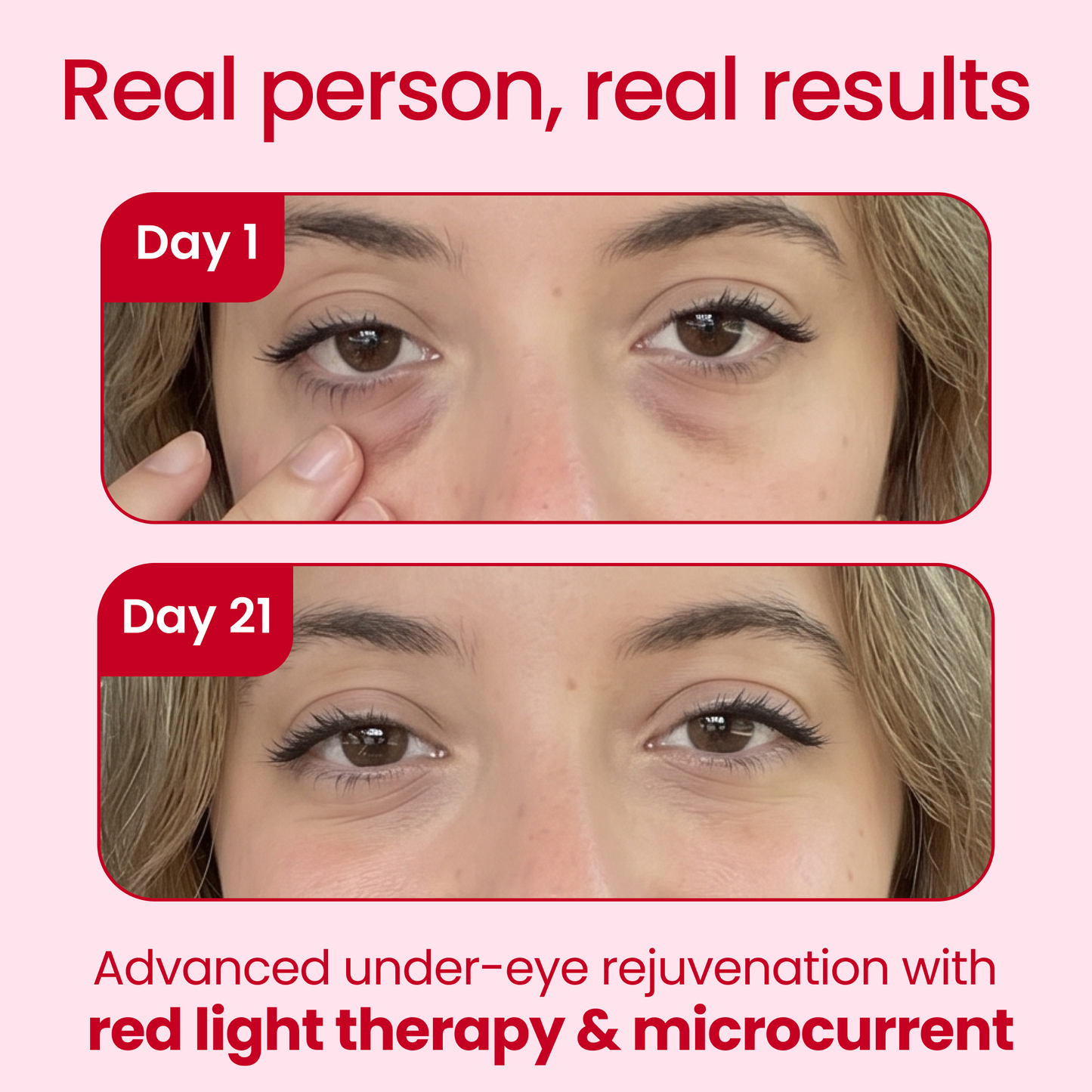 🔥Free Shipping🔥-Redlight + Microcurrent Glasses
