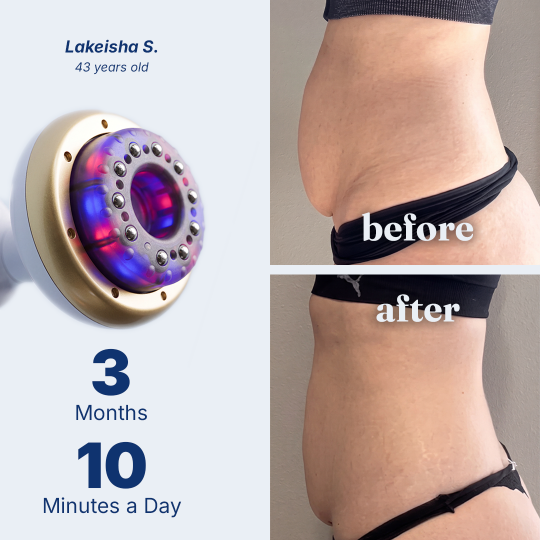 Cotitoc® Firmer, More Toned Skin