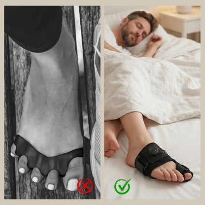 🔥Adjustable Bunion Corrector – Gentle Toe Alignment & Daily Pain Relief