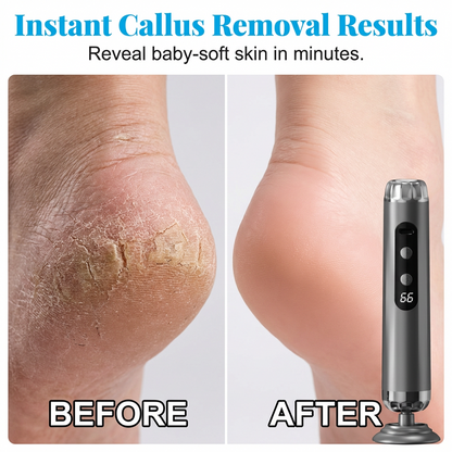 🔥2026 Hot Sale⏰Multi-Function Electric Foot Grinder with 5 Speeds